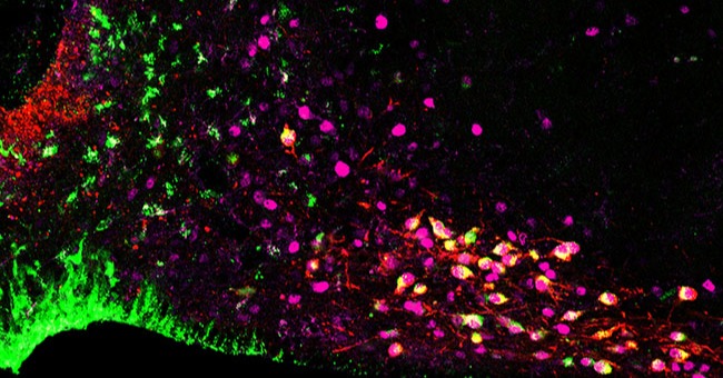 gonadotrophin-releasing hormone neuron tn