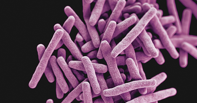 A University of Otago-led study has found highly vulnerable weakness in drug-resistant Mycobacterium tuberculosis, offering a new way to kill them. 