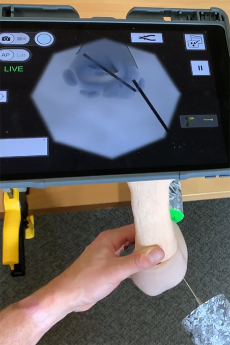 A simulator machine showing virtual 3D image of a bone.