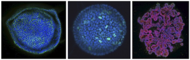 Gastric organoids, Home, Centre for Translational Cancer Research ...